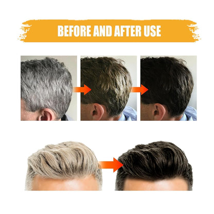 Black Soap Bar Shampoo for Men Hair and Beard Repair