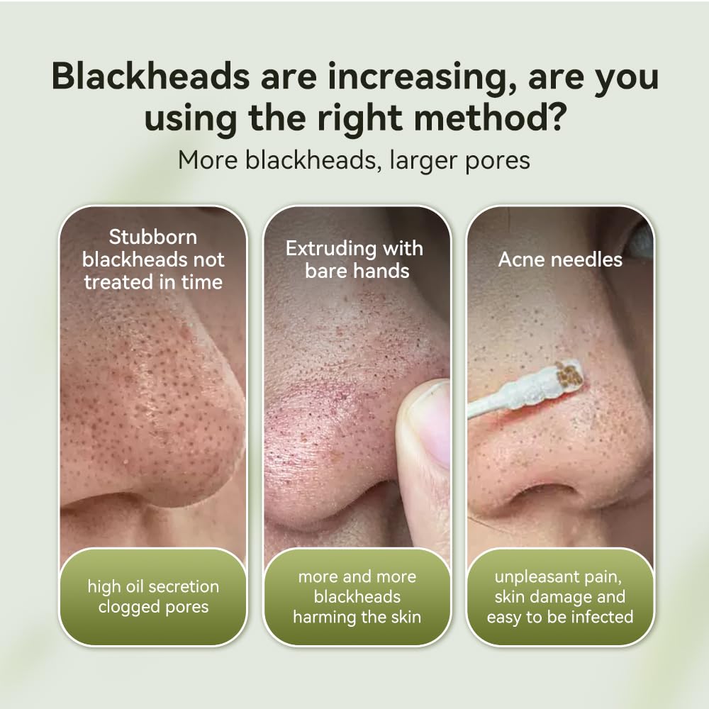 LANBENA Blackhead Mask